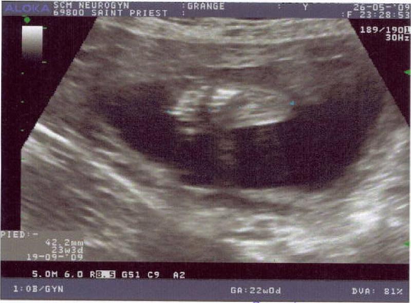Grange2009_Pied.jpg - Le petit pied de ma future soeur...