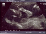 Grange2009_Profil