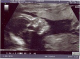 Grange2009_Profil2